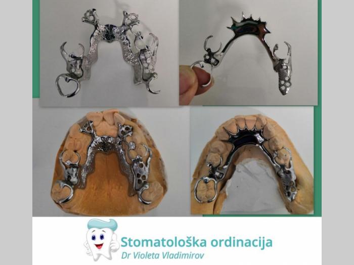 keramičke krunice sremska mitrovica besplatni mali oglasi