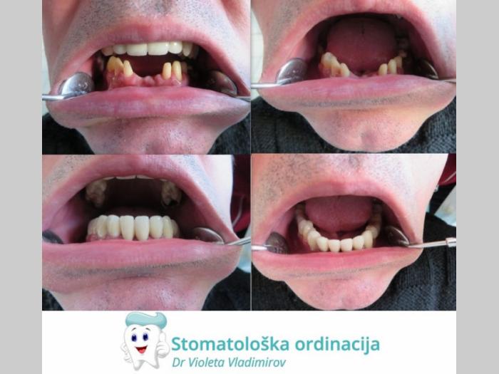 keramičke krunice sremska mitrovica besplatni mali oglasi