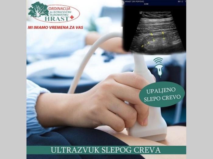 ultra zvuk abdomena vračar besplatni mali oglasi